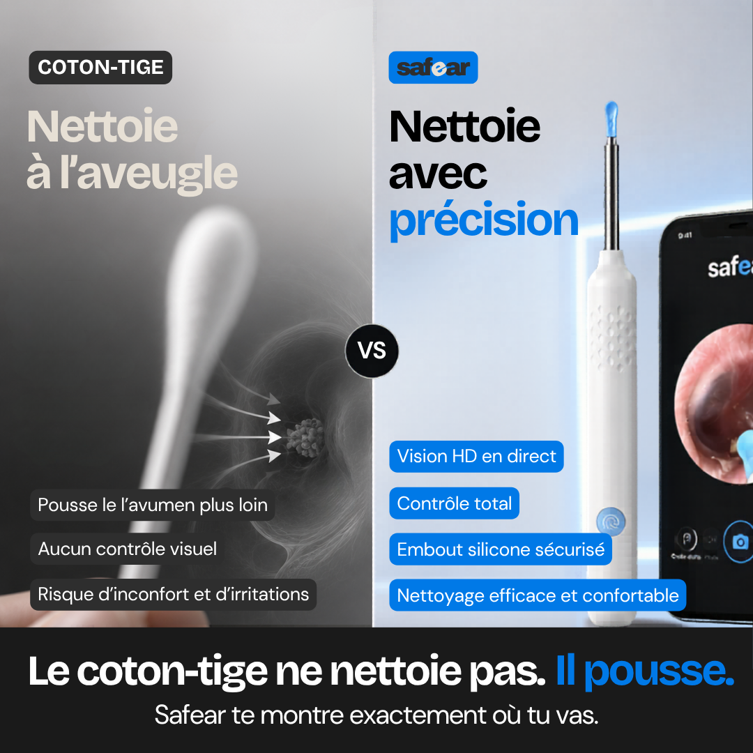 Néora — Nettoyeur d'oreilles connecté avec caméra Wi-Fi HD
